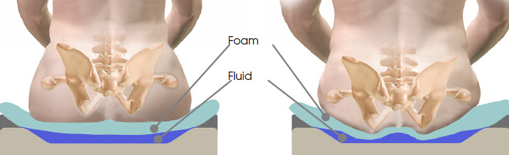 https://www.rehabmart.com/images_html2/Sunrise%20Medical(SM)%202011/union%20foam%20fluid%20base.jpg