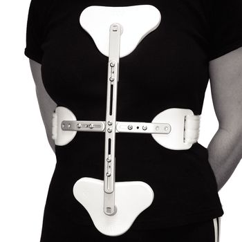 C.A.S.H. (Cruciform Anterior Spinal Hyperextension) Orthosis