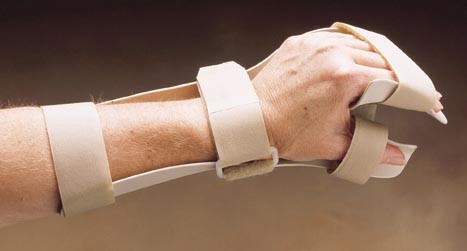 Wrist Orthosis | Hand Splint | Hand Orthosis | Custom Orthotics | Orthosis