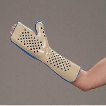 Splinting Casting And Alternatives | Fracture Immobilization | Splints ...