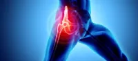 7 Products for Hip Replacement Recovery Success