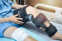 The Best ACL Braces for Post Surgery and Active Use