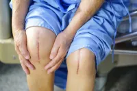 Top 5 Mistakes After Knee Replacement [WITH VIDEO]