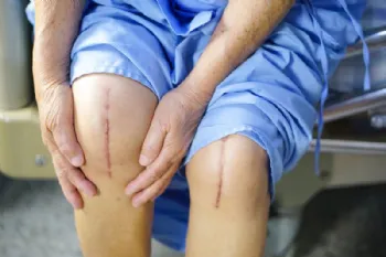 Top 5 Mistakes After Knee Replacement [WITH VIDEO]