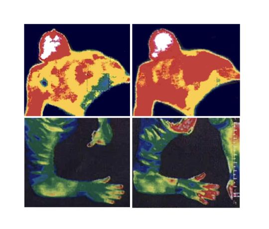 Shown before and after an 8 minute session