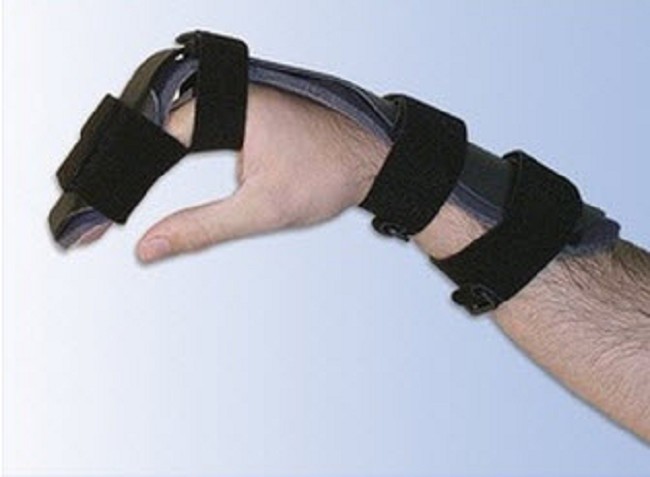 Dorsal Blocking Splint L Code