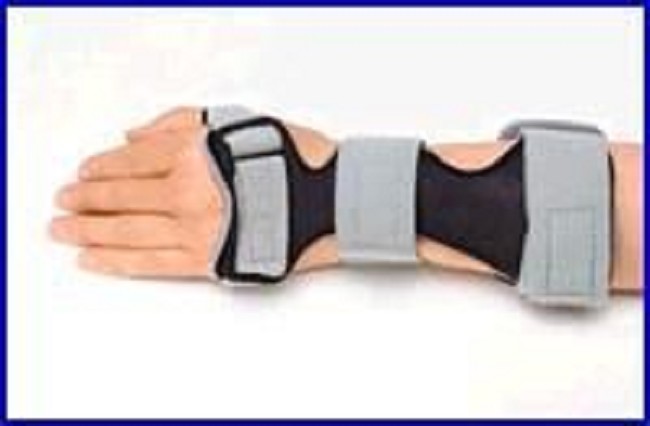 Dorsal Carpal Tunnel Splint