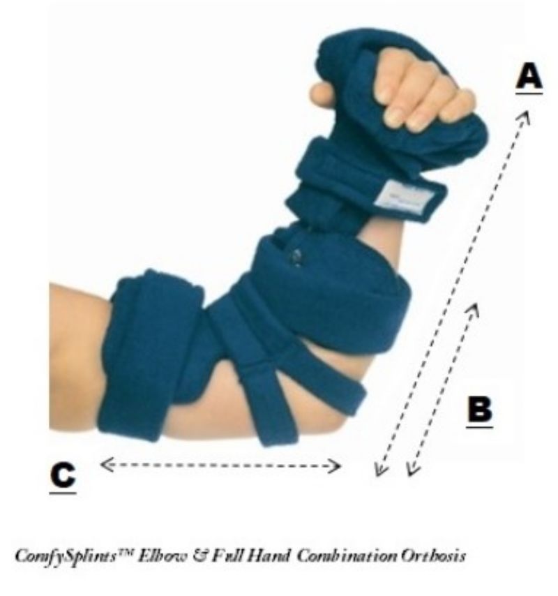 Comfy Splints Elbow Hand Combination Orthosis Picture