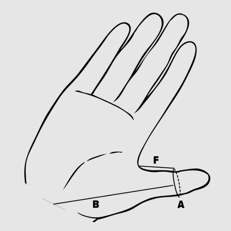 Neonatal Thumb Splints by McKie Splints Picture