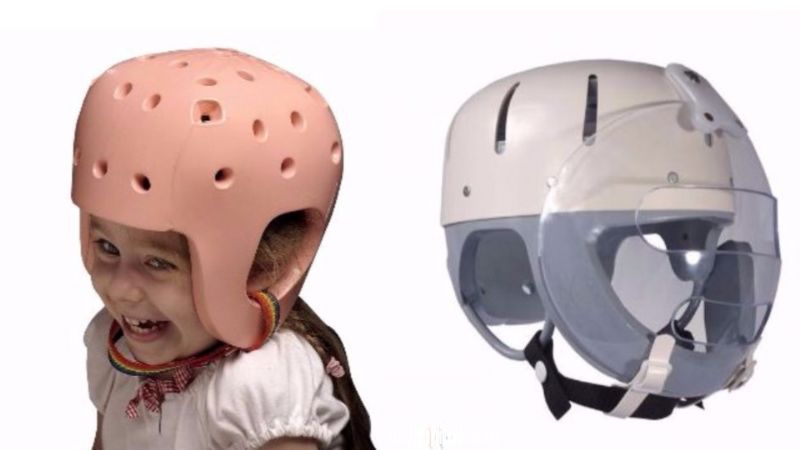 Baby Protective Helmet: Useful to avoid injuries