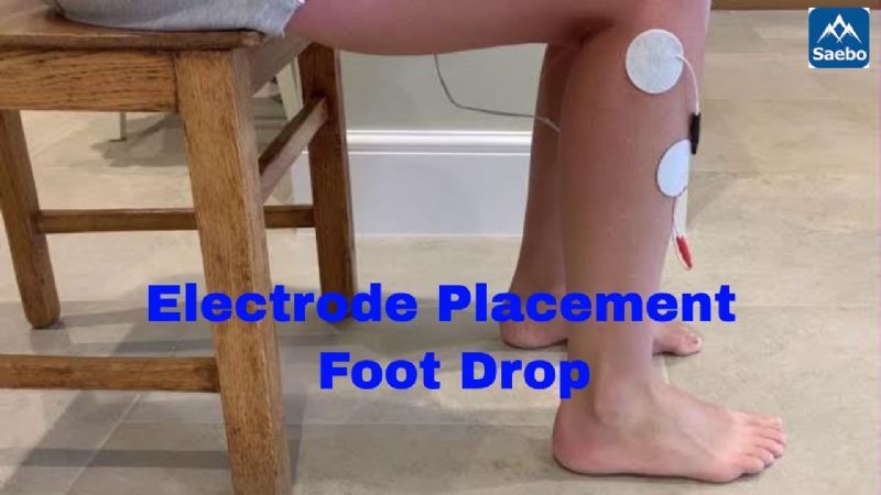 HOW TO GET ROUND FOOT-DROP AFTER STROKE